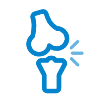 Arthroscopy