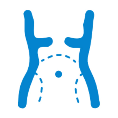 Laparoscopy