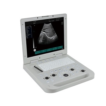 IMGX-20 Full-digital Laptop Ultrasound Scanner
