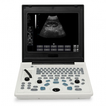IMGX-60 Full Digital Ultrasound Scanner