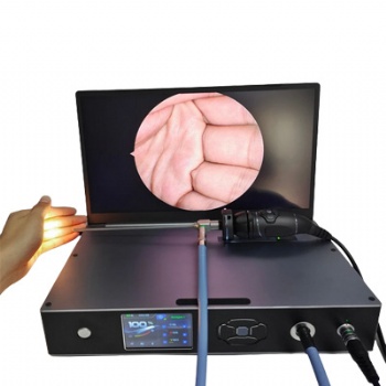 Linkview2200 endoscope camera system