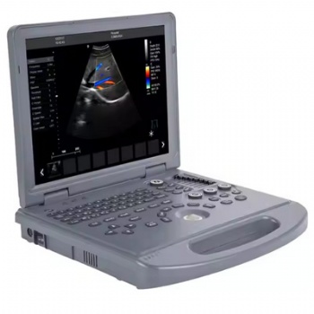 Laptop Color Doppler Ultrasound System