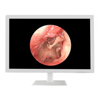 Medical Grade Surgical Monitor